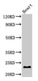 Western Blot Positive WB detected in: Mouse heart tissue All lanes: CRYBA4 antibody at 3µg/ml Secondary Goat polyclonal to rabbit IgG at 1/50000 dilution Predicted band size: 23 kDa Observed band size: 23 kDa
