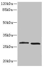 Western blot All lanes: CRYBB1 antibody at 1.58µg/ml Lane 1: MCF-7 whole cell lysate Lane 2: Mouse kidney tissue Secondary Goat polyclonal to Rabbit IgG at 1/10000 dilution Predicted band size: 28 kDa Observed band size: 28 kDa