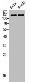 Western Blot analysis of HeLa HepG2 cells using TERT Polyclonal Antibody