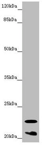 Western blot All lanes: CRYGS antibody at 6.87 ug/ml + Mouse eye tissue Secondary Goat polyclonal to rabbit IgG at 1/10000 dilution Predicted band size: 21 kDa Observed band size: 21, 23 kDa