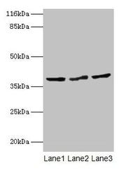 Western blot All lanes: CRYZL1 antibody at 12µg/ml Lane 1: Hela whole cell lysate Lane 2: HepG2 whole cell lysate Lane 3: Jurkat whole cell lysate Secondary Goat polyclonal to rabbit IgG at 1/10000 dilution Predicted band size: 39, 22 kDa Observed...
