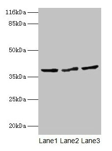 Western blot All lanes: CRYZL1 antibody at 12µg/ml Lane 1: Hela whole cell lysate Lane 2: HepG2 whole cell lysate Lane 3: Jurkat whole cell lysate Secondary Goat polyclonal to rabbit IgG at 1/10000 dilution Predicted band size: 39, 22 kDa Observed...