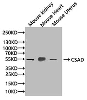 Western Blot Positive WB detected in: Mouse Kidney tissue lysate(20µg),Mouse Heart tissue lysate(20µg),Mouse Uterus tissue lysate(20µg) All lanes: CSAD antibody at 1:1000 Secondary Goat polyclonal to rabbit IgG at 1/50000 dilution Predicted band s...