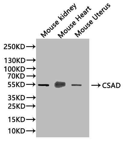 Western Blot Positive WB detected in: Mouse Kidney tissue lysate(20µg),Mouse Heart tissue lysate(20µg),Mouse Uterus tissue lysate(20µg) All lanes: CSAD antibody at 1:1000 Secondary Goat polyclonal to rabbit IgG at 1/50000 dilution Predicted band s...