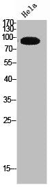 Western Blot analysis of HeLa cells using TRPC3 Polyclonal Antibody
