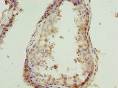 Immunohistochemistry of paraffin-embedded human testis tissue using CSB-PA006033LA01HU at dilution of 1:100