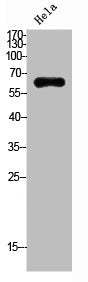 Western Blot analysis of HeLa cells using Netrin-1 Polyclonal Antibody