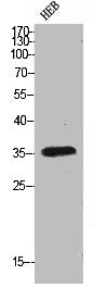 Western Blot analysis of HEB cells using FAS Polyclonal Antibody