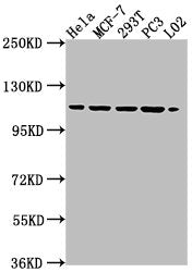 Western Blot Positive WB detected in: HeLa whole cell lysate, MCF-7 whole cell lysate, 293T whole cell lysate, PC3 whole cell lysate, L02 whole cell lysate All lanes: CSE1L antibody at 1:2000 Secondary Goat polyclonal to rabbit IgG at 1/50000 dilu...