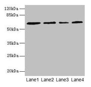 Western blot All lanes: CSGALNACT2 antibody at 4µg/ml Lane 1: K562 whole cell lysate Lane 2: 293T whole cell lysate Lane 3: Jurkat whole cell lysate Lane 4: PC-3 whole cell lysate Secondary Goat polyclonal to rabbit IgG at 1/10000 dilution Predict...