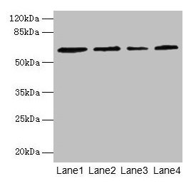 Western blot All lanes: CSGALNACT2 antibody at 4µg/ml Lane 1: K562 whole cell lysate Lane 2: 293T whole cell lysate Lane 3: Jurkat whole cell lysate Lane 4: PC-3 whole cell lysate Secondary Goat polyclonal to rabbit IgG at 1/10000 dilution Predict...