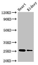 Western Blot Positive WB detected in: Mouse heart tissue, Mouse kidney tissue All lanes: CSH2 antibody at 4ug/ml Secondary Goat polyclonal to rabbit IgG at 1/50000 dilution Predicted band size: 25, 19, 14 kDa Observed band size: 25 kDa