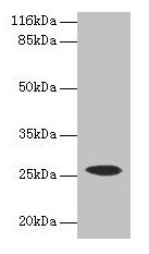 Western blot All lanes: CSHL1 antibody at 2µg/ml + Human placenta tissue Secondary Goat polyclonal to rabbit IgG at 1/10000 dilution Predicted band size: 26, 23, 16, 15 kDa Observed band size: 26 kDa