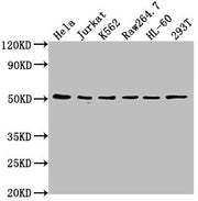 Western Blot Positive WB detected in: Hela whole cell lysate, Jurkat whole cell lysate, K562 whole cell lysate, Raw264.7 whole cell lysate, HL-60 whole cell lysate, 293T whole cell lysate All lanes: CSK antibody at 1:2000 Secondary Goat polyclonal...