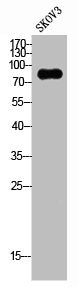 Western Blot analysis of SKOV3 cells using G-CSFR Polyclonal Antibody