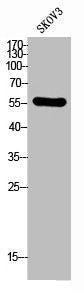 Western Blot analysis of SKOV3 cells using CD292 Polyclonal Antibody