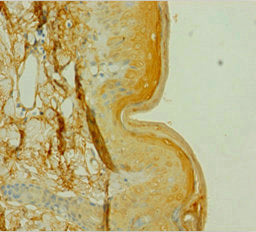 Immunohistochemistry of paraffin-embedded human skin tissue using CSB-PA006065LA01HU at dilution of 1:100