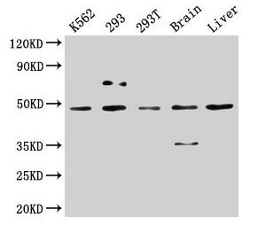 Western Blot Positive WB detected in: K562 whole cell lysate, 293 whole cell lysate, 293T whole cell lysate, Rat brain tissue, Mouse liver tissue All lanes: CSNK1D antibody at 5µg/ml Secondary Goat polyclonal to rabbit IgG at 1/50000 dilution Pred...