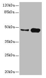 Western blot All lanes: CSNK1G2 antibody at 4.21ug/ml Lane 1: Mouse gonadal tissue Lane 2: Hela whole cell lysate Secondary Goat polyclonal to rabbit IgG at 1/10000 dilution Predicted band size: 47 kDa Observed band size: 47 kDa