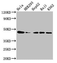 Western Blot Positive WB detected in: Hela whole cell lysate, HEK293 whole cell lysate, HepG2 whole cell lysate, Raji whole cell lysate, K562 whole cell lysate All lanes: CSNK2A1 antibody at 3µg/ml Secondary Goat polyclonal to rabbit IgG at 1/5000...