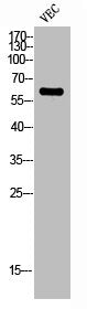 Western Blot analysis of VEC cells using ZNF384 Polyclonal Antibody