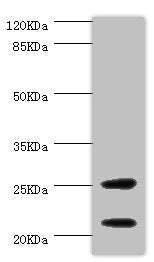 Western blot All lanes: CSRP3 antibody at 1ug/ml + Mouse skeletal muscle tissue Secondary Goat polyclonal to rabbit IgG at 1/10000 dilution Predicted band size: 21 kDa Observed band size: 21, 25 kDa