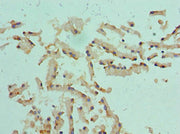 Immunohistochemistry of paraffin-embedded human prostate tissue using CSB-PA006088ESR1HU at dilution of 1:100