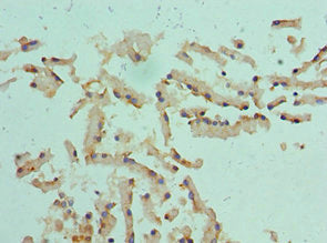 Immunohistochemistry of paraffin-embedded human prostate tissue using CSB-PA006088ESR1HU at dilution of 1:100