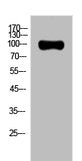 Western Blot analysis of Hela cells using AR Polyclonal Antibody.