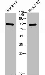 Western Blot analysis of HepG2-UV cells using Cortactin Polyclonal Antibody