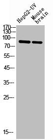 Western Blot analysis of HepG2-UV mouse brain cells using Stat1 Polyclonal Antibody