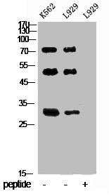 Western Blot analysis of K562 L929 cells using Ub Polyclonal Antibody