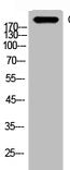 Western Blot analysis of AD293 cells using C4a/b Polyclonal Antibody.