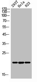 Western Blot analysis of 293T Hela 823 cells using ANG I Polyclonal Antibody