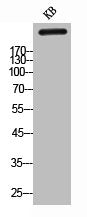 Western Blot analysis of KB cells using Tenascin-C Polyclonal Antibody
