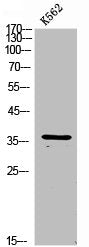 Western Blot analysis of K562 cells using 11β-HSD1 Polyclonal Antibody