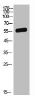 Western Blot analysis of MCF7 cells using TNAP Polyclonal Antibody.