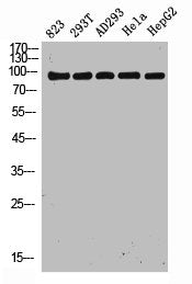 Western Blot analysis of 823 293T AD293 Hela HepG2 cells using NOXIN Polyclonal Antibody