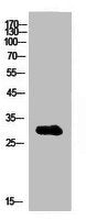Western Blot analysis of MCF7 cells using IGFBP1 Polyclonal Antibody.
