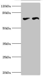 Western blot All lanes: Transcriptional repressor CTCF antibody at 6ug/ml Lane 1: PC-3 whole cell lysate Lane 2: MCF-7 whole cell lysate Secondary Goat polyclonal to rabbit IgG at 1/10000 dilution Predicted band size: 83, 46 kDa Observed band size...