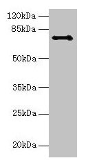 Western blot All lanes: Ctcfl antibody at 6µg/ml + Hela whole cell lysate Secondary Goat polyclonal to rabbit IgG at 1/10000 dilution Predicted band size: 74, 75 kDa Observed band size: 74 kDa