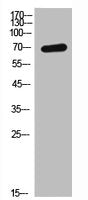 Western Blot analysis of SKOV3 cells using GHR Polyclonal Antibody.