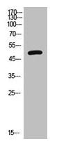 Western Blot analysis of HepG2 cells using VPAC1 Polyclonal Antibody.