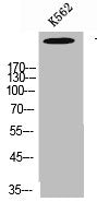 Western Blot analysis of K562 cells using Talin-1 Polyclonal Antibody