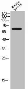 Western Blot analysis of MOUSE-BRAIN cells using CD19 Polyclonal Antibody