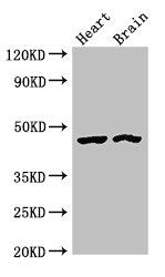 Western Blot Positive WB detected in: Rat heart tissue, Mouse brain tissue All lanes: CTH antibody at 4ug/ml Secondary Goat polyclonal to rabbit IgG at 1/50000 dilution Predicted band size: 45, 40, 42 kDa Observed band size: 45 kDa