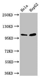 Western Blot Positive WB detected in: Hela whole cell lysate, HepG2 whole cell lysate All lanes: CTNNA1 antibody at 3.3µg/ml Secondary Goat polyclonal to rabbit IgG at 1/50000 dilution Predicted band size: 101, 103, 60 kDa Observed band size: 101 kDa