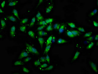 Immunofluorescence staining of Hela cells with CSB-PA006165LA01HU at 1:133, counter-stained with DAPI. The cells were fixed in 4% formaldehyde, permeabilized using 0.2% Triton X-100 and blocked in 10% normal Goat Serum. The cells were then incubat...
