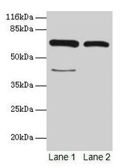 Western blot All lanes: CTPS1 antibody at 6µg/ml Lane 1: Hela whole cell lysate Lane 2: 293T whole cell lysate Secondary Goat polyclonal to rabbit IgG at 1/10000 dilution Predicted band size: 67, 42 kDa Observed band size: 67 kDa