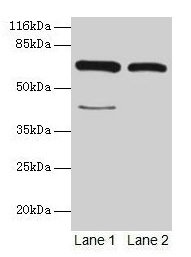 Western blot All lanes: CTPS1 antibody at 6µg/ml Lane 1: Hela whole cell lysate Lane 2: 293T whole cell lysate Secondary Goat polyclonal to rabbit IgG at 1/10000 dilution Predicted band size: 67, 42 kDa Observed band size: 67 kDa